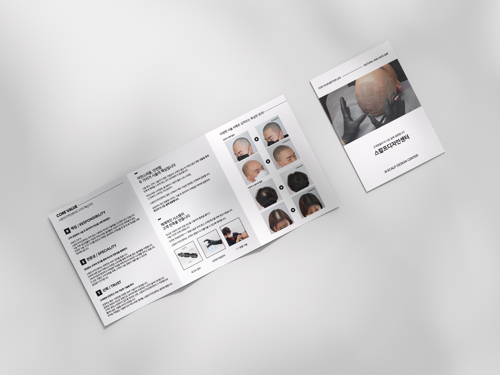 스칼프디자인센터 3단 브로슈어 — Core Value(책임·전문성·신뢰)와 시술 사례, 시스템 소개 지면